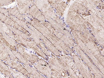 VDAC1 Recombinant Rabbit Monoclonal Antibody (Mitochondrial Loading Control)