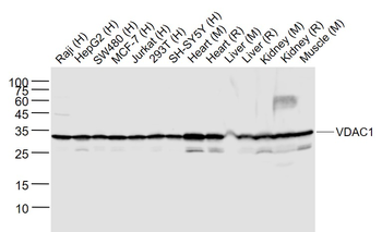VDAC1 Recombinant Rabbit Monoclonal Antibody (Mitochondrial Loading Control)