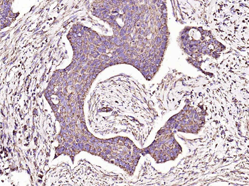 VDAC1 Recombinant Rabbit Monoclonal Antibody (Mitochondrial Loading Control)
