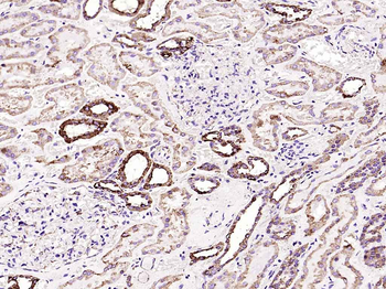 VDAC1 Recombinant Rabbit Monoclonal Antibody (Mitochondrial Loading Control)