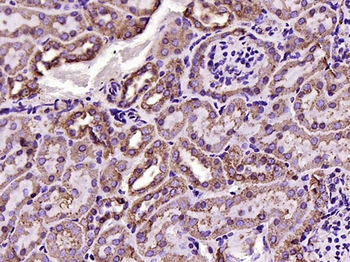 VDAC1 Recombinant Rabbit Monoclonal Antibody (Mitochondrial Loading Control)