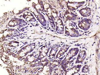 VDAC1 Recombinant Rabbit Monoclonal Antibody (Mitochondrial Loading Control)