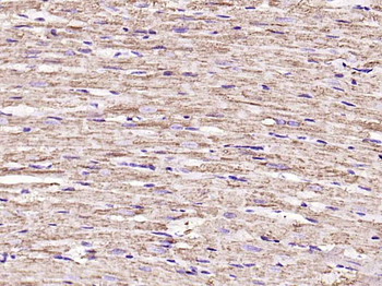 VDAC1 Recombinant Rabbit Monoclonal Antibody (Mitochondrial Loading Control)