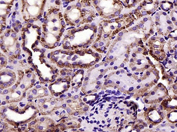 VDAC1 Recombinant Rabbit Monoclonal Antibody (Mitochondrial Loading Control)
