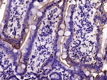 ACE2 Rabbit Polyclonal Antibody