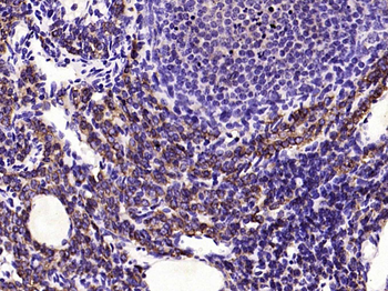 ACE2 Rabbit Polyclonal Antibody