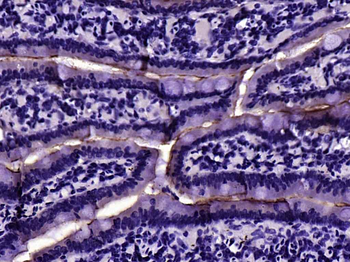 ACE2 Rabbit Polyclonal Antibody
