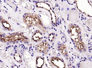 ACE2 Rabbit Polyclonal Antibody