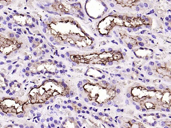 ACE2 Rabbit Polyclonal Antibody