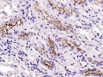 ACE2 Rabbit Polyclonal Antibody