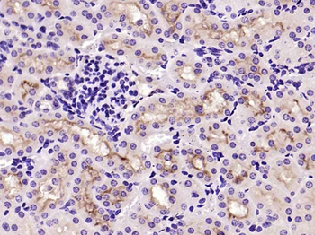 ACE2 Rabbit Polyclonal Antibody