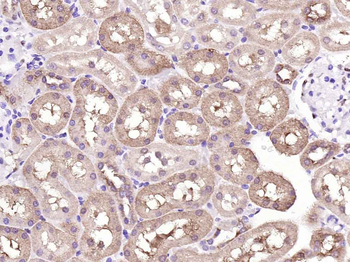 GAPDH Recombinant Rabbit Monoclonal Antibody (Loading Control)