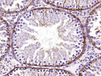 GAPDH Recombinant Rabbit Monoclonal Antibody (Loading Control)