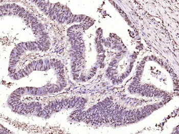 GAPDH Recombinant Rabbit Monoclonal Antibody (Loading Control)