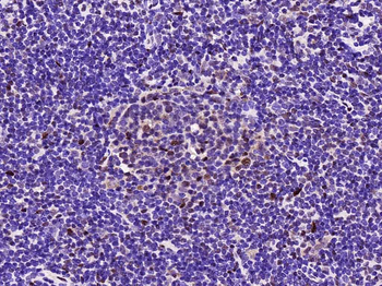 GAPDH Recombinant Rabbit Monoclonal Antibody (Loading Control)