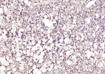 PPM1D Rabbit Polyclonal Antibody
