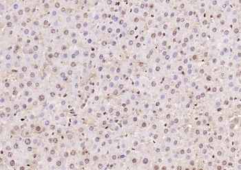 PPM1D Rabbit Polyclonal Antibody