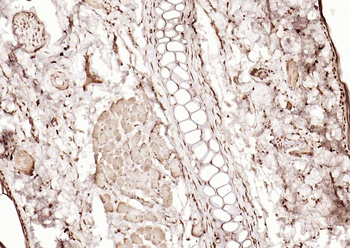 PPM1D Rabbit Polyclonal Antibody