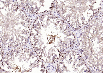 PPM1D Rabbit Polyclonal Antibody