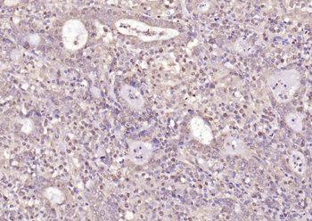 PPM1D Rabbit Polyclonal Antibody