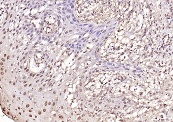 PPM1D Rabbit Polyclonal Antibody