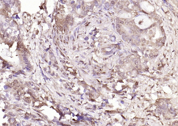 PPM1D Rabbit Polyclonal Antibody