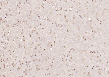 PPM1D Rabbit Polyclonal Antibody