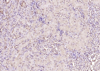 PPM1D Rabbit Polyclonal Antibody