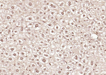 PPM1D Rabbit Polyclonal Antibody