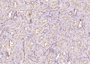 PPM1D Rabbit Polyclonal Antibody