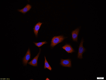 Ubiquitin Mouse Monoclonal Antibody