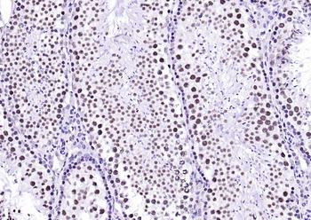 Ubiquitin Mouse Monoclonal Antibody