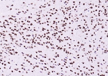 Ubiquitin Mouse Monoclonal Antibody