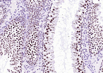 Ubiquitin Mouse Monoclonal Antibody