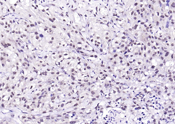 Ubiquitin Mouse Monoclonal Antibody