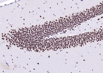 Ubiquitin Mouse Monoclonal Antibody