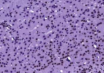 Ubiquitin Mouse Monoclonal Antibody