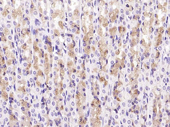 TAK1 Rabbit Polyclonal Antibody