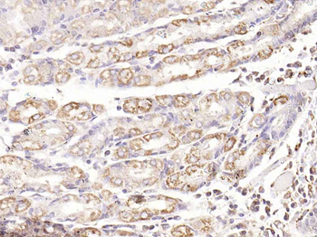 Phospho-TAK1 (Thr187) Rabbit Polyclonal Antibody