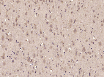 Phospho-TAK1 (Thr187) Rabbit Polyclonal Antibody