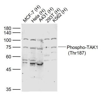 Phospho-TAK1 (Thr187) Rabbit Polyclonal Antibody
