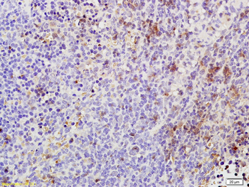 Phospho-TAK1 (Thr184 + Thr187) Rabbit Polyclonal Antibody