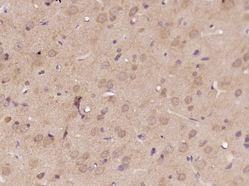 Phospho-MAP3K7IP1 (Thr431) Rabbit Polyclonal Antibody