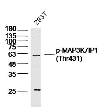 Phospho-MAP3K7IP1 (Thr431) Rabbit Polyclonal Antibody