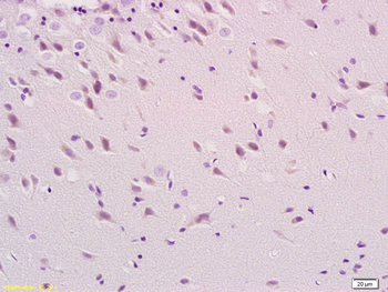 Phospho-Tau (Ser396) Rabbit Polyclonal Antibody