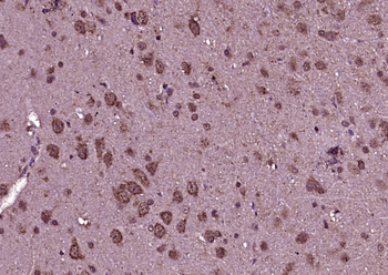 Phospho-Tau (Ser422) Rabbit Polyclonal Antibody