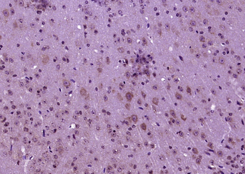 Phospho-Tau (Ser262) Rabbit Polyclonal Antibody