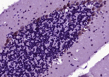 Phospho-Tau (Ser262) Rabbit Polyclonal Antibody