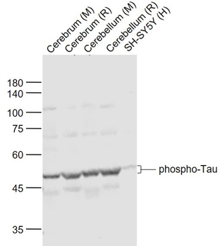 Phospho-Tau (Ser404) Rabbit Polyclonal Antibody