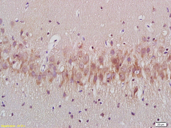 Phospho-Tau (Ser404) Rabbit Polyclonal Antibody
